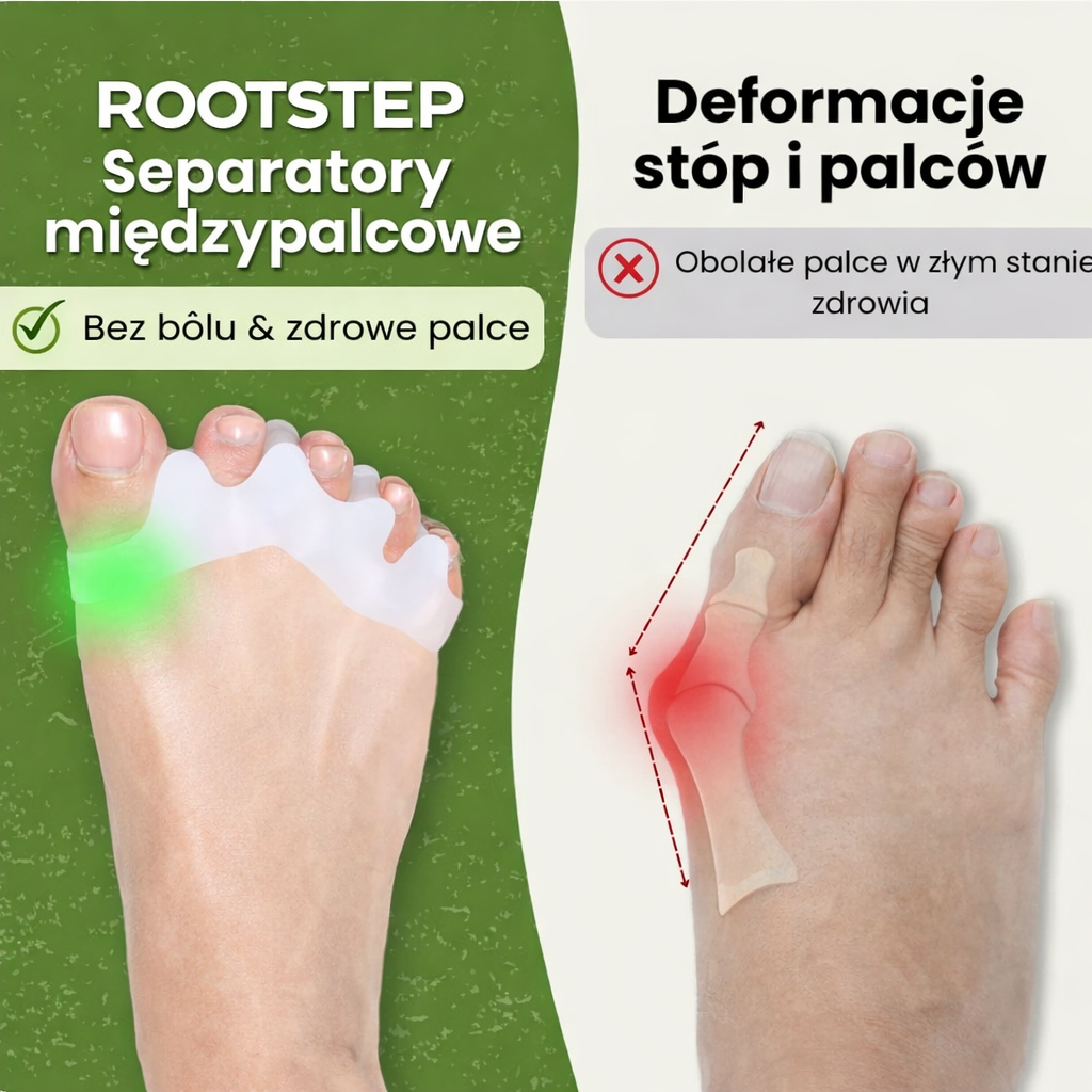 Separator palców Rootstep – do codziennego komfortu, miękkiego wsparcia palców oraz odpowiedni przy haluksach i palcach młotkowatych Rootstep PL